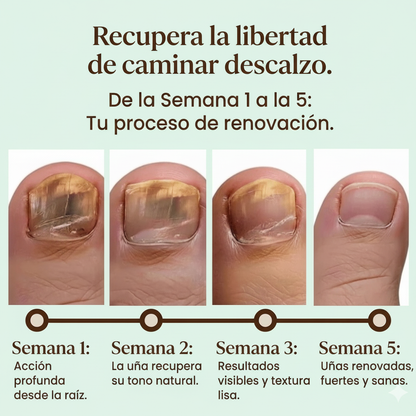 Recupera la libertad de caminar descalzo